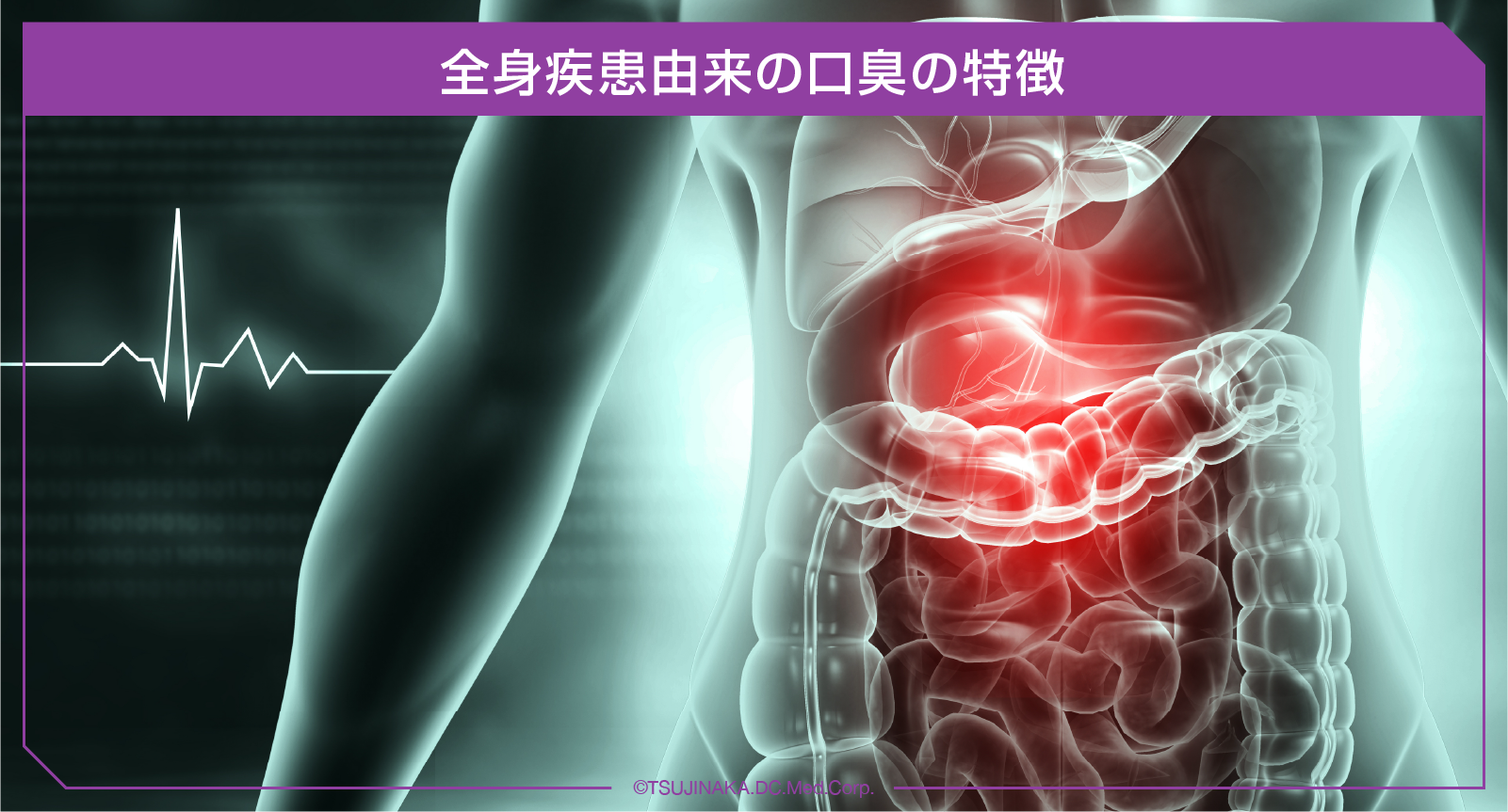全身疾患由来の口臭の特徴