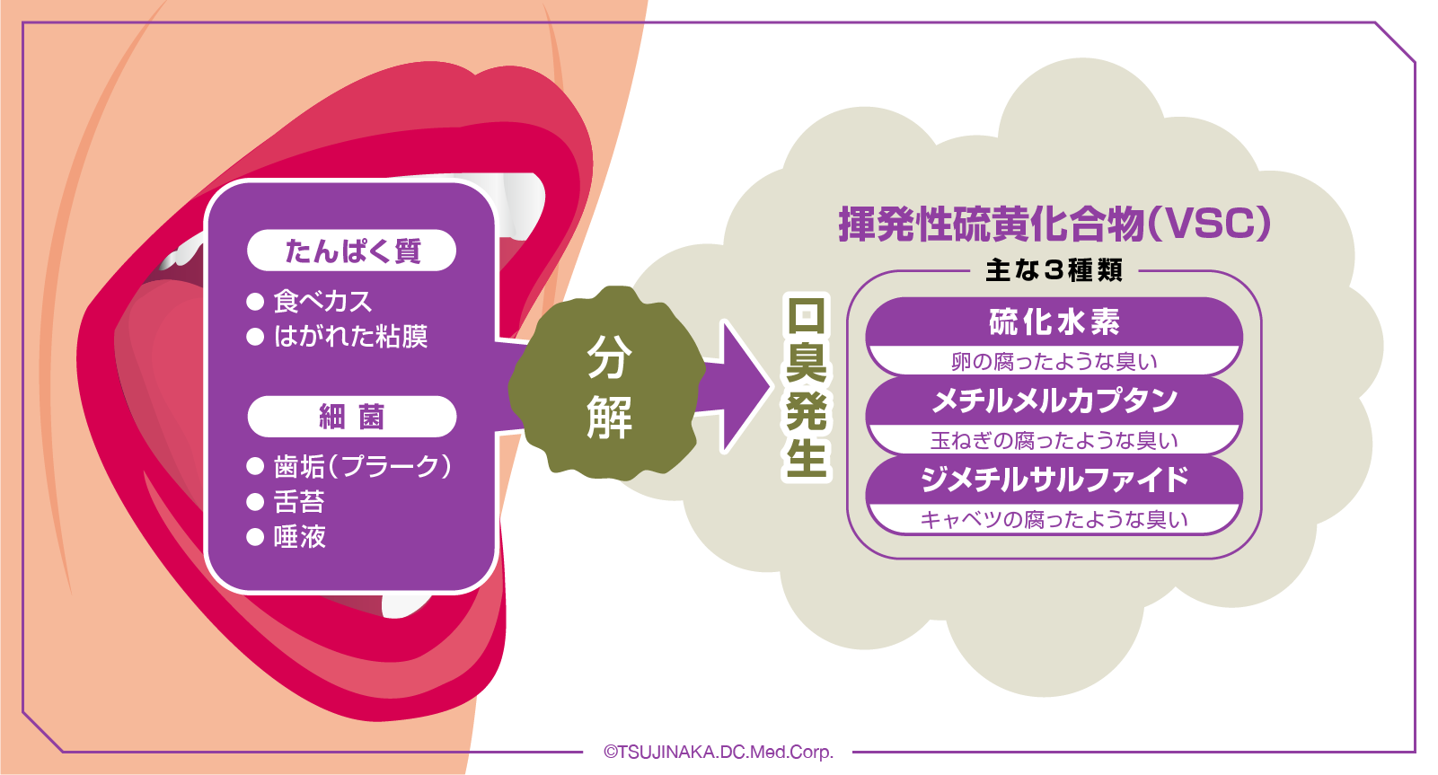 揮発性硫黄化合物（VSC）