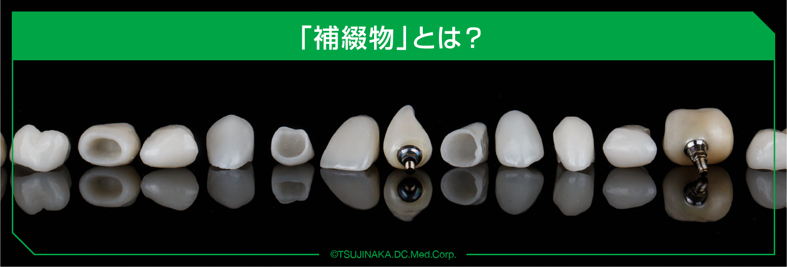 補綴物とは？