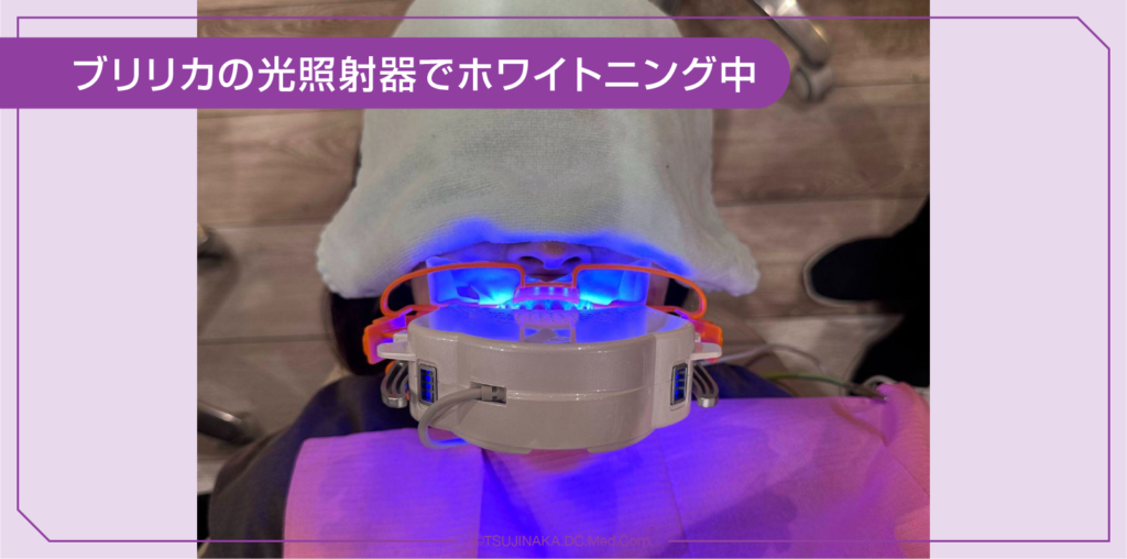 ブリリカの光照射器でホワイトニング中