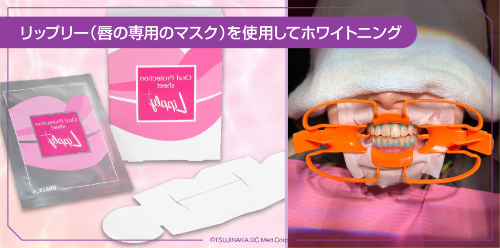リップリー（唇の専用のマスク）を使用してホワイトニング