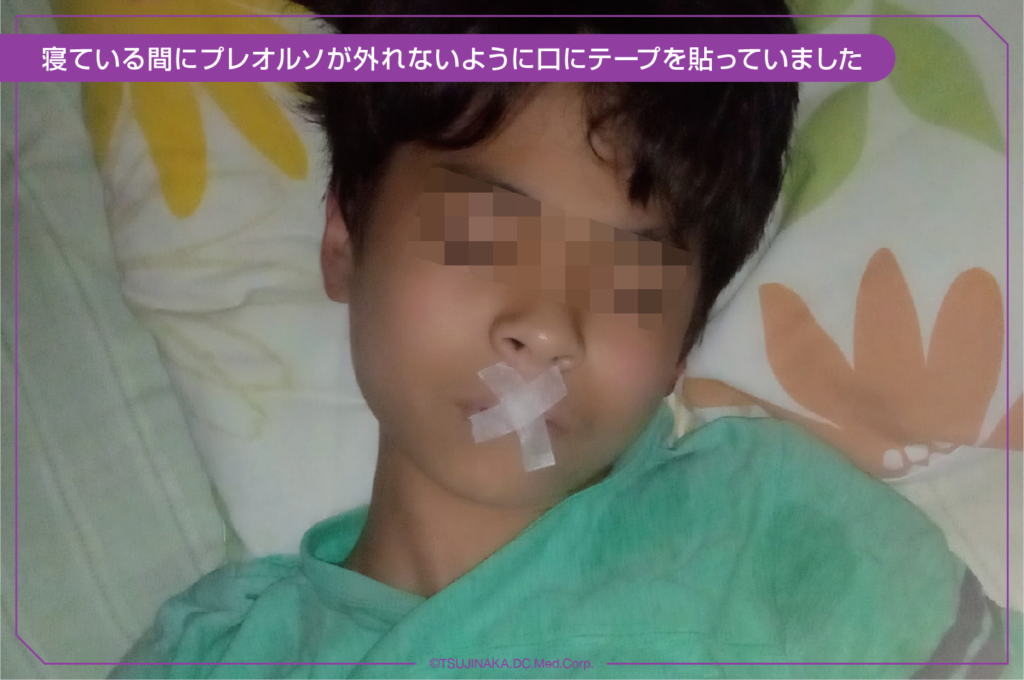 寝ている間にプレオルソが外れないように口にテープを貼っていました