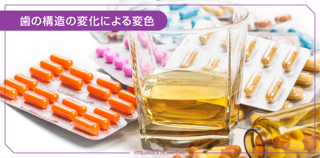 歯の構造の変化による変色