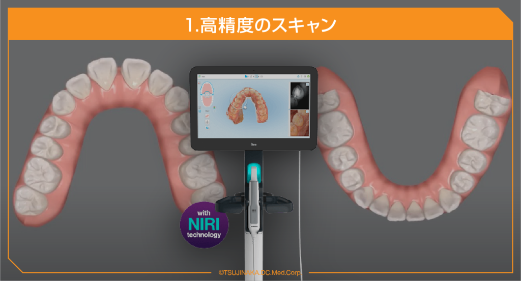 1.高精度のスキャン