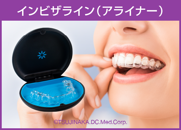 インビザライン（アライナー）