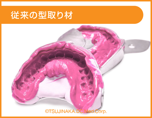 従来の型取り材