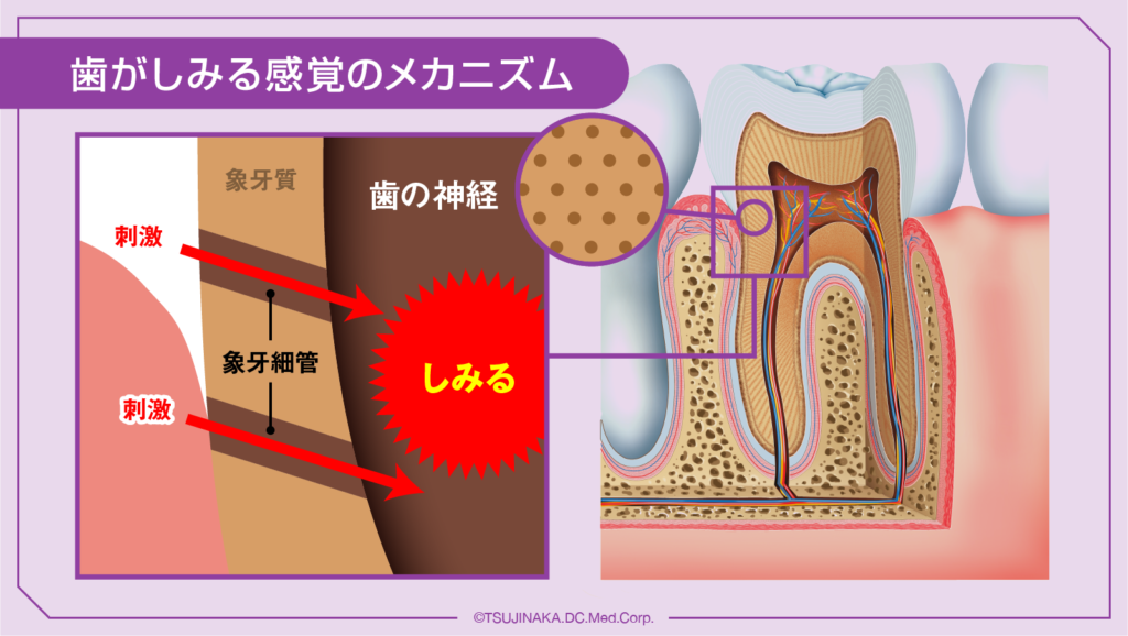 歯がしみる感覚のメカニズム