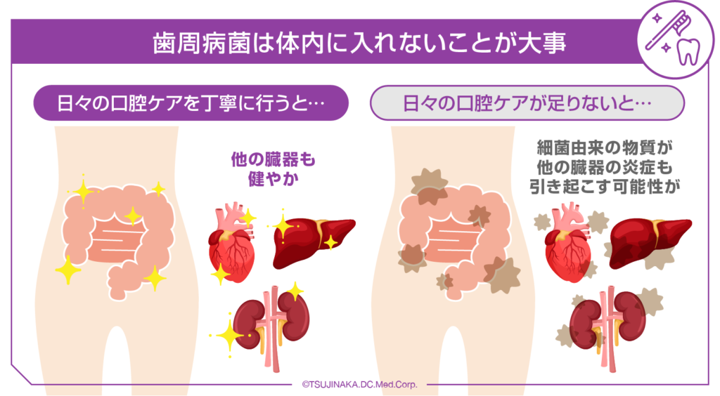 歯周病菌は体内に入れないことが大事