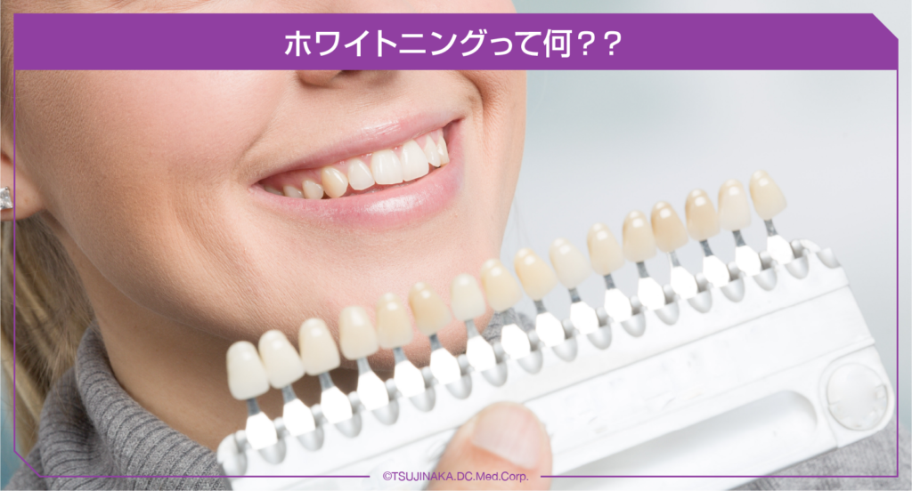 ホワイトニングって何？？