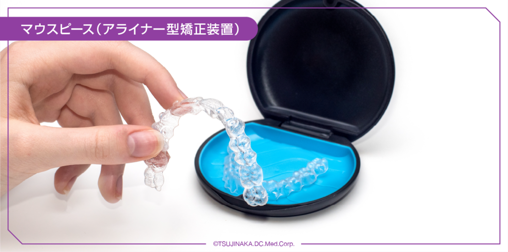 マウスピース（アライナー型矯正装置）