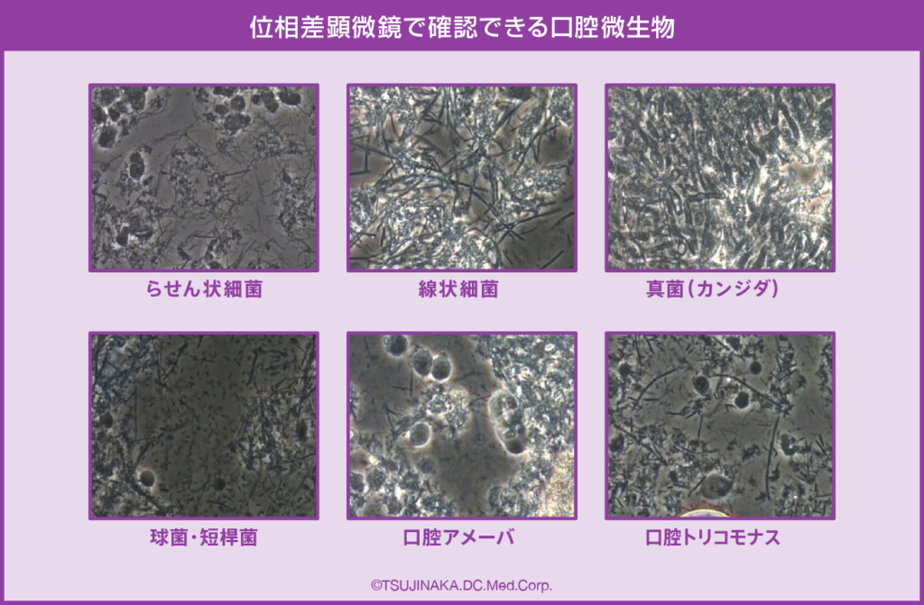 位相差顕微鏡で確認できる口腔微生物