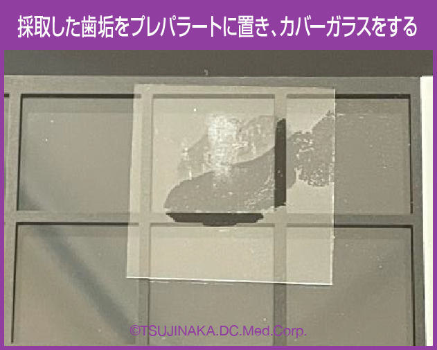 採取した歯垢をプレパラートに置き、カバーガラスをする