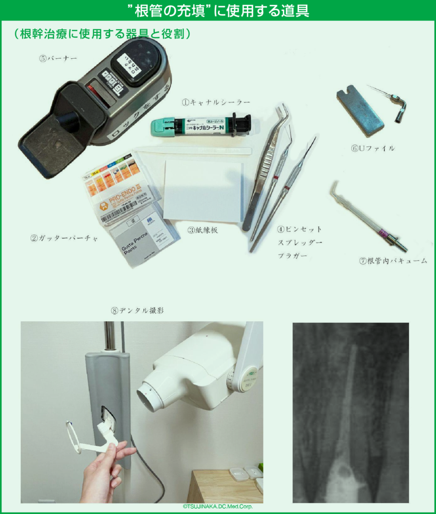 ”根管の充填”に使用する道具