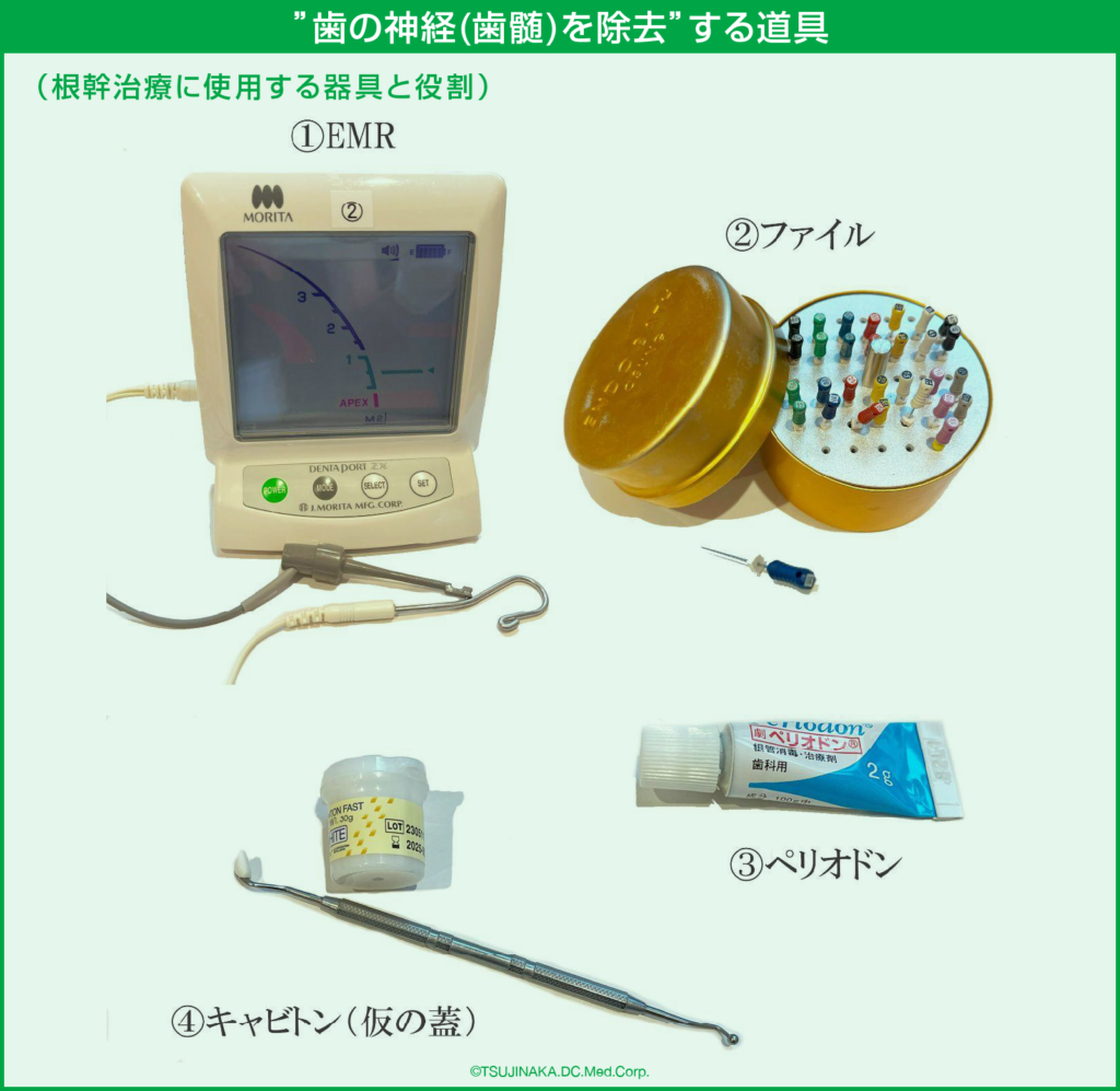 ”歯の神経(歯髄)を除去”する道具