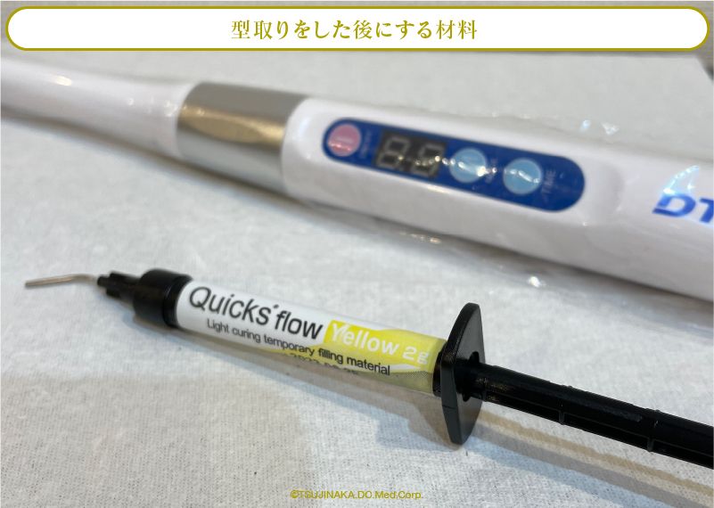 型取りをした後にする材料