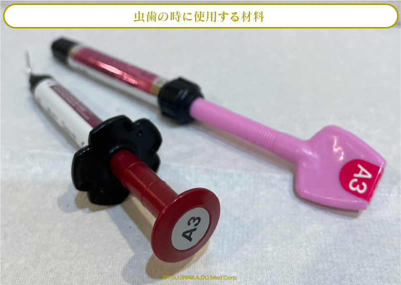 虫歯の時に使用する材料