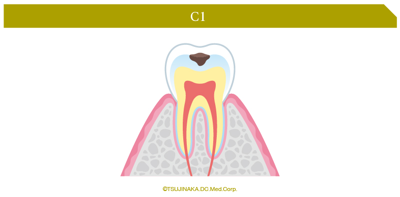 C1