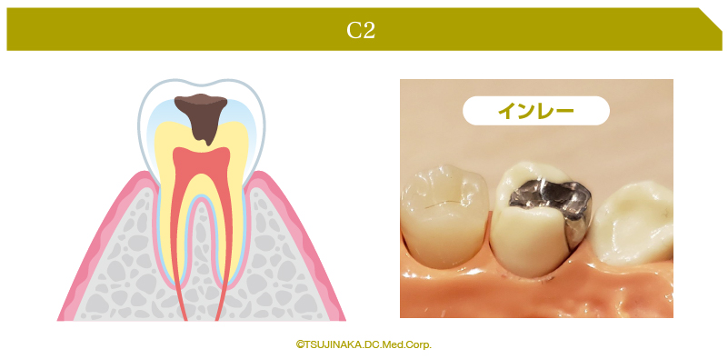 C2