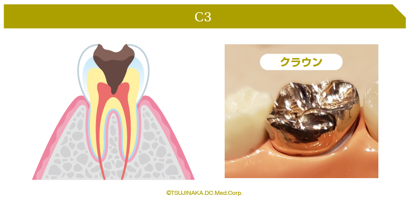 C3