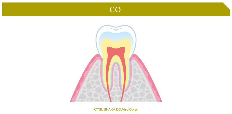 CO