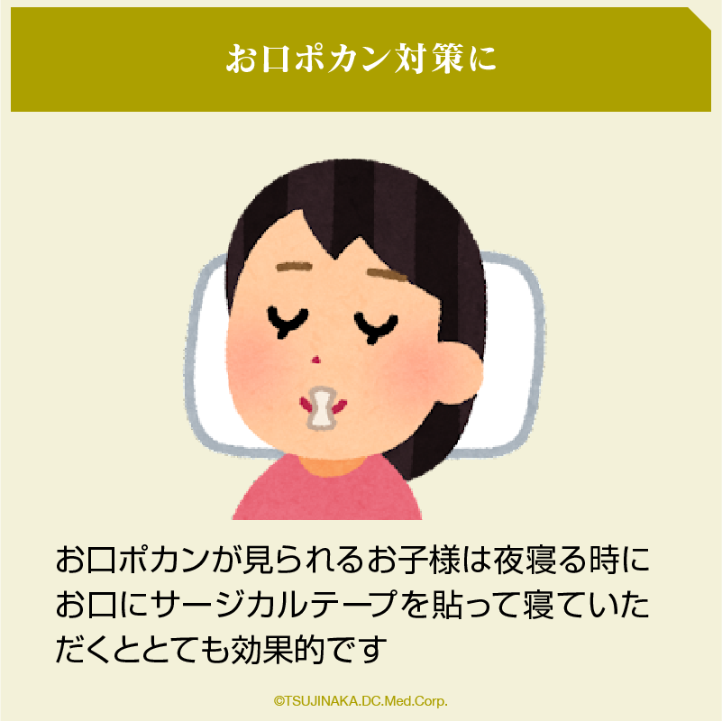 お口ポカン対策に