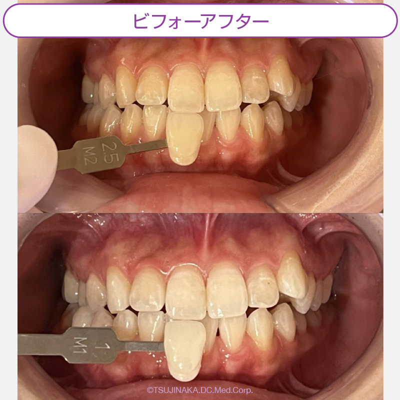 ビフォーアフター