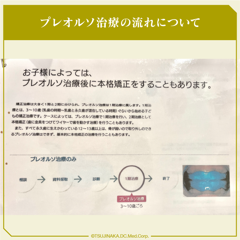 プレオルソ治療の流れについて