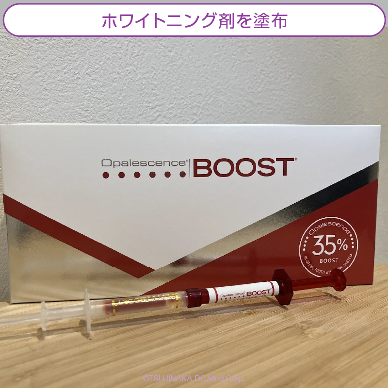 ホワイトニング剤を塗布