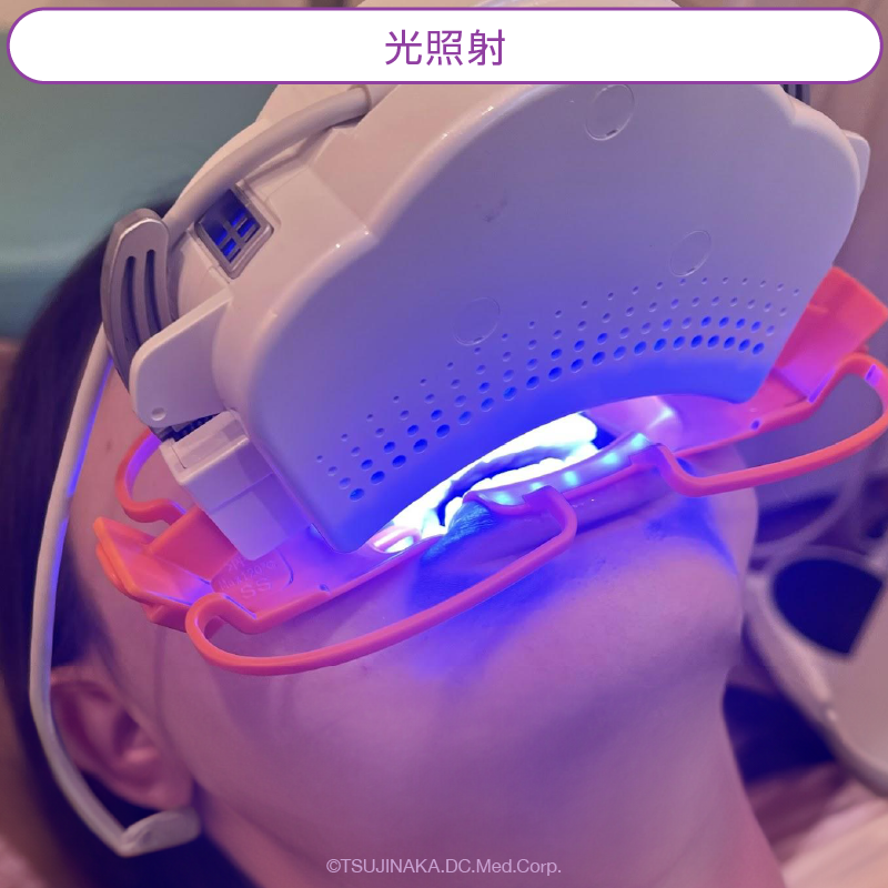 光照射