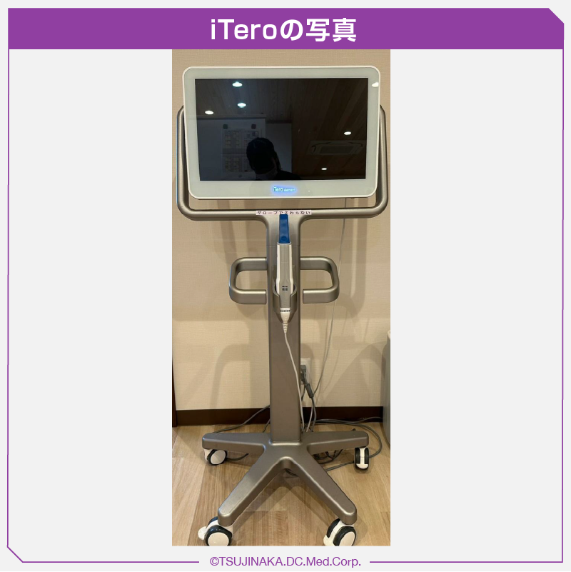 iTeroの写真