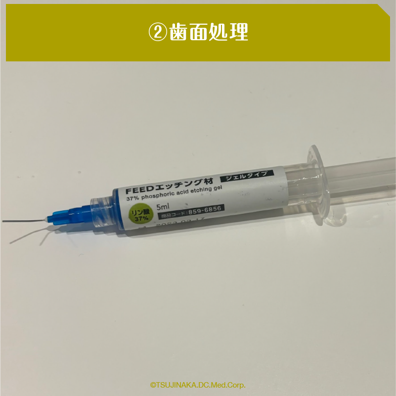 ②歯面処理