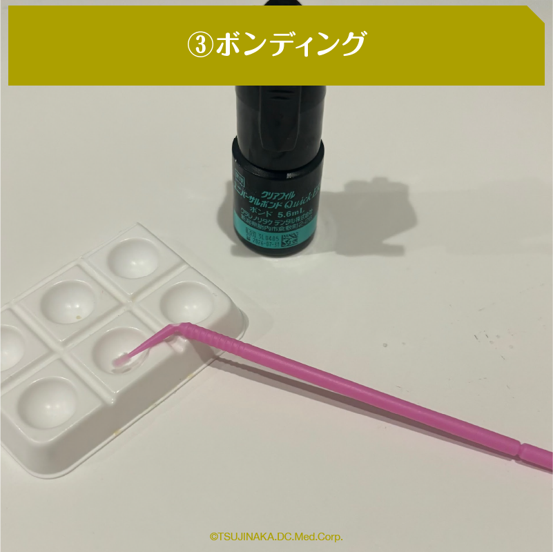 ③ボンディング
