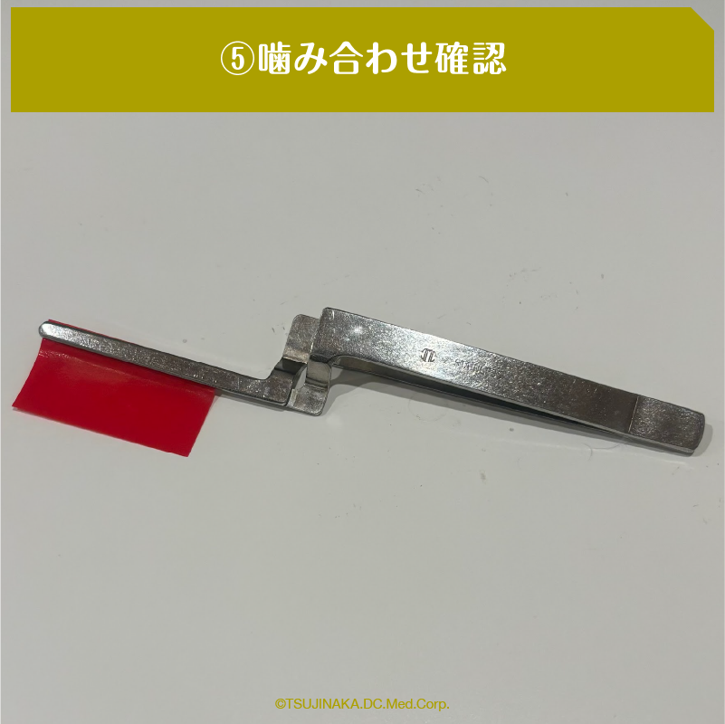 ⑤噛み合わせ確認
