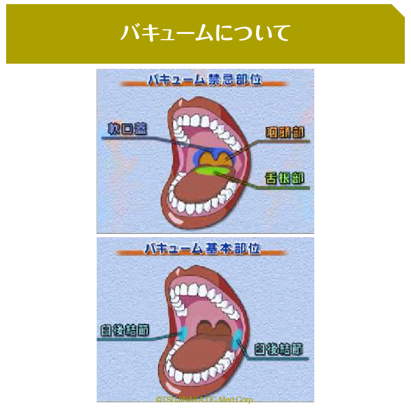 バキュームについて