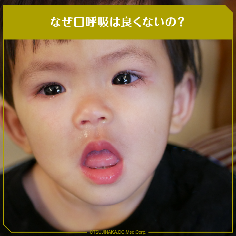 なぜ口呼吸は良くないの？