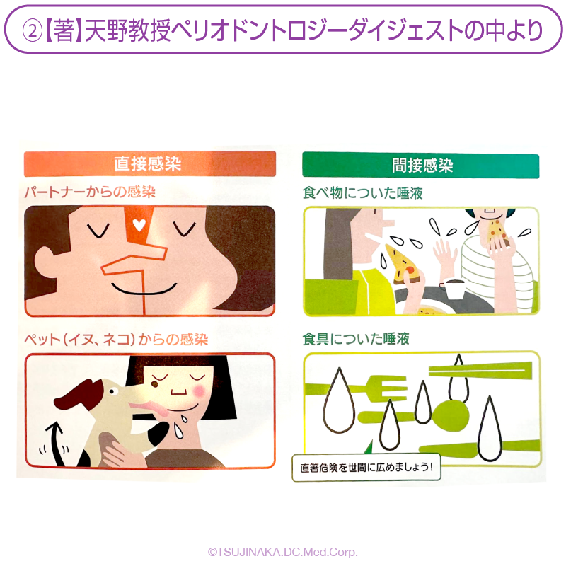 ②【著】天野教授ペリオドントロジーダイジェストの中より