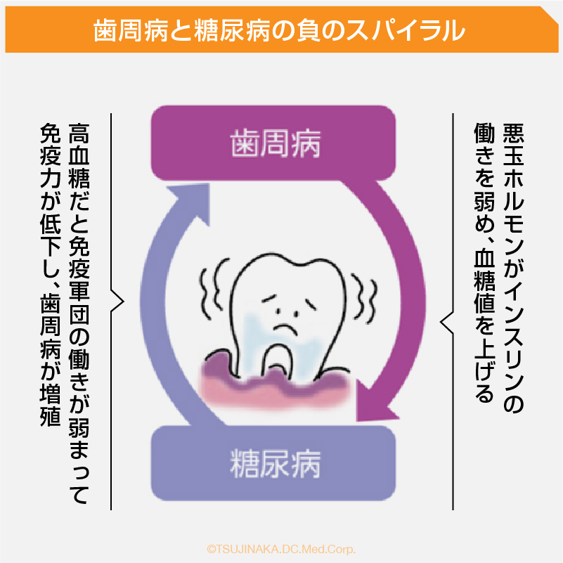 歯周病と糖尿病の負のスパイラル