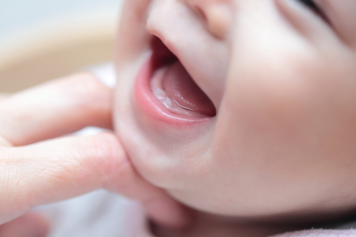 虫歯治療の適齢期の子ども