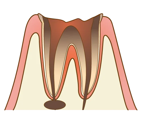 サンプル