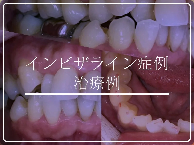 症例集