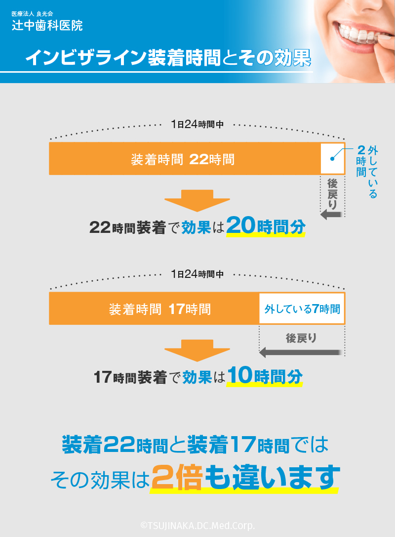 インビザライン装着時間と効果