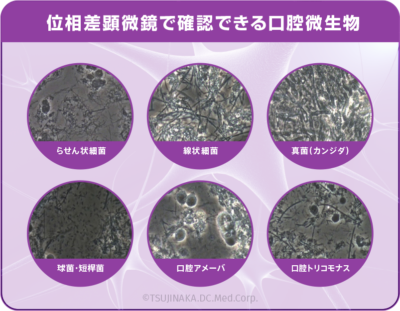位相差顕微鏡で確認できる口腔微生物