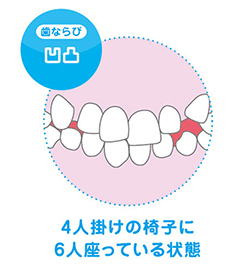 凹凸