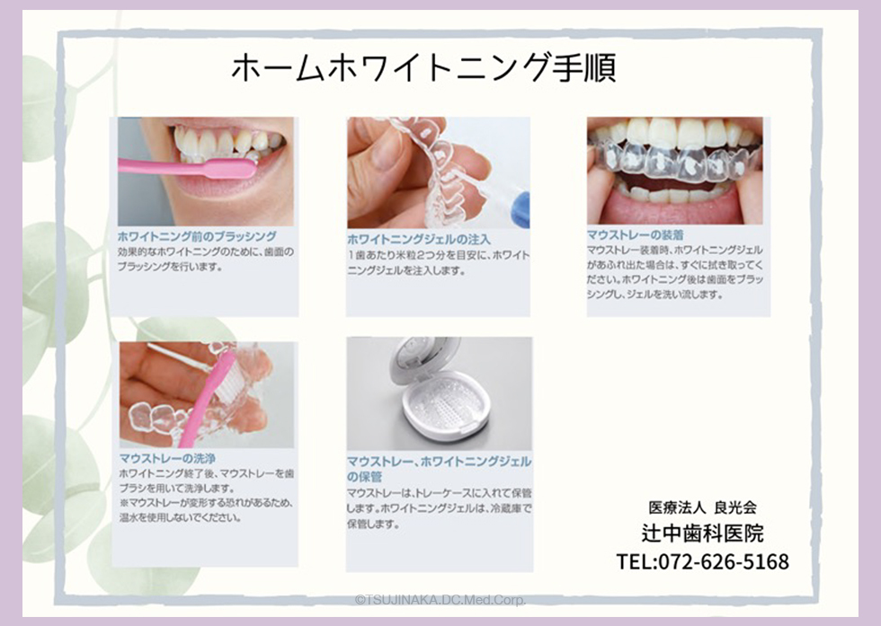 ホワイトニング手順