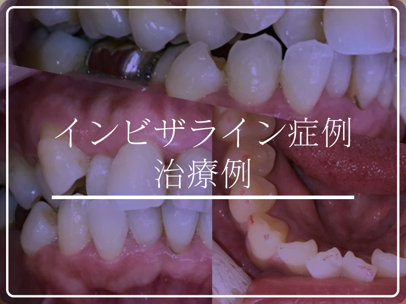 syourei_link_