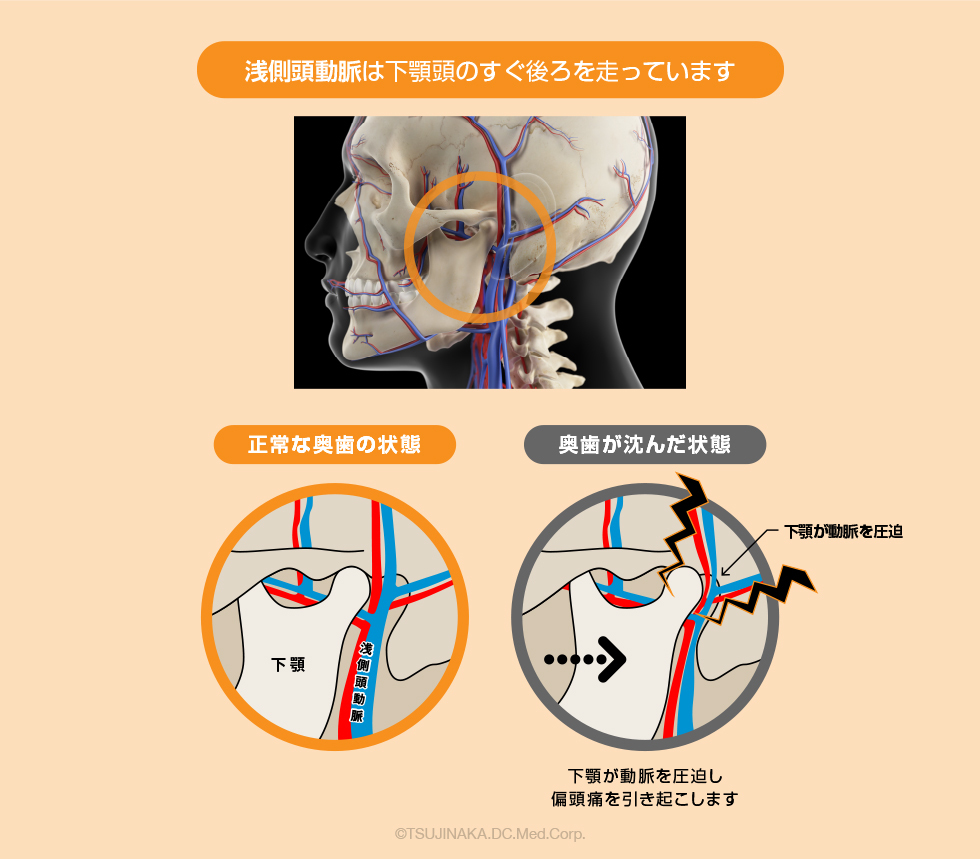せんそくとう動脈
