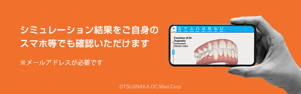 3Dシミュレーション結果はスマホでも確認いただけます