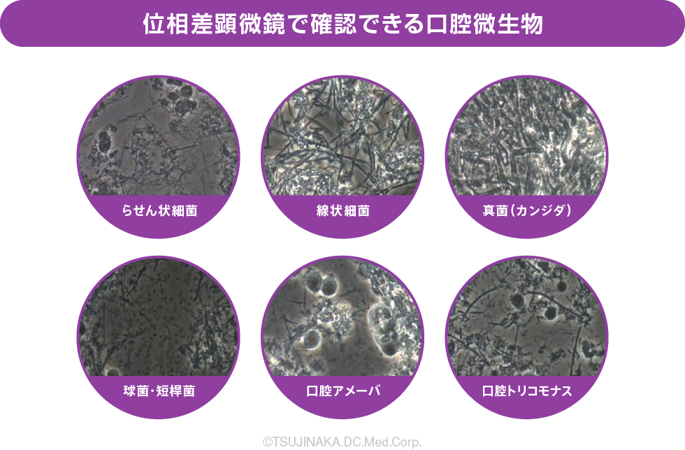 位相差顕微鏡で確認できる口腔微生物