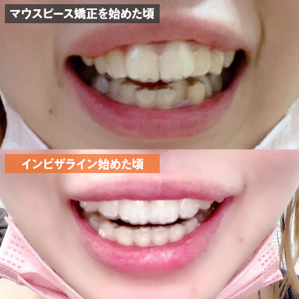 ビフォーアフター