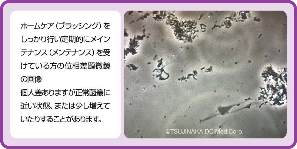 位相差顕微鏡の画像2